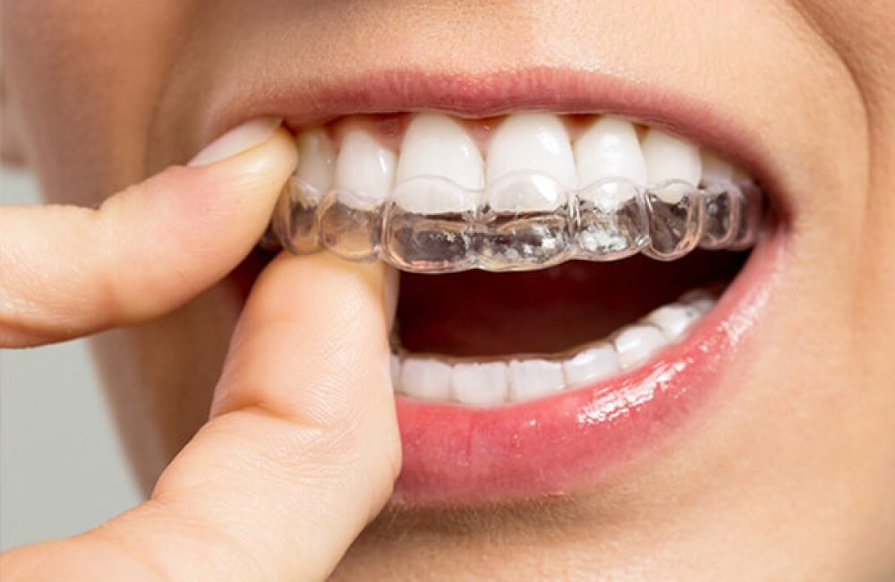 dis-sikma-tedavisi-durumlari