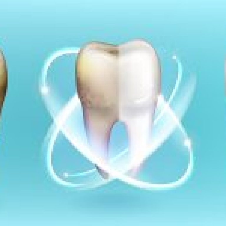 disbeyzlatma-foto-300x150