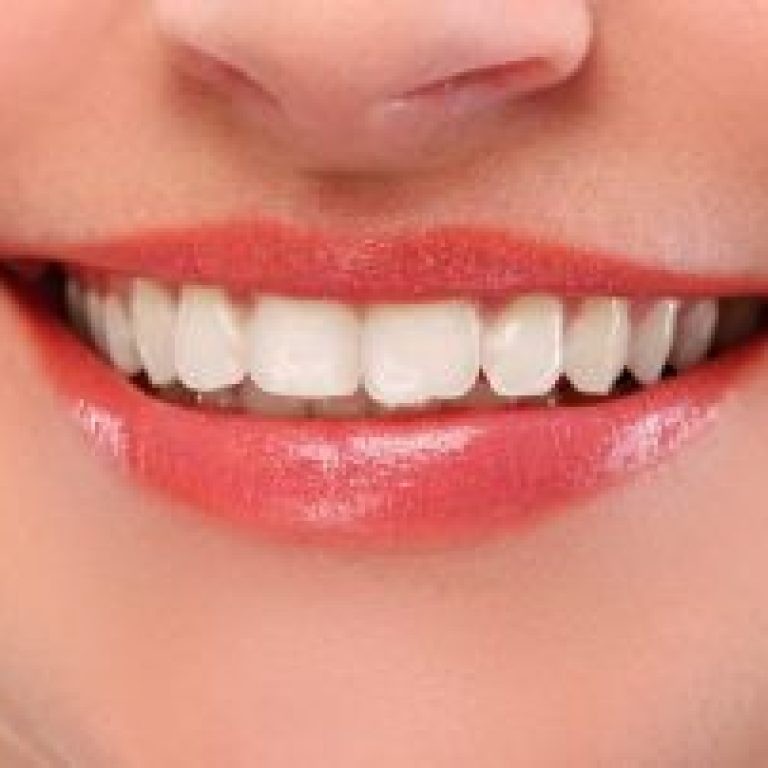 kanal-tedavisi-agrili-midir-320x202