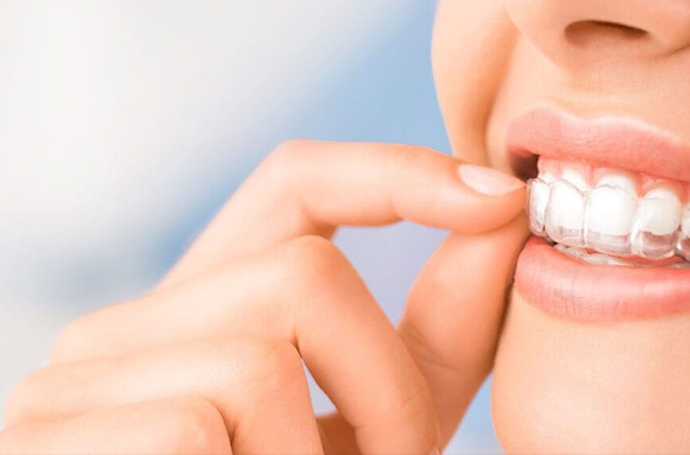 nisantasi-dis-sikma-tedavisi