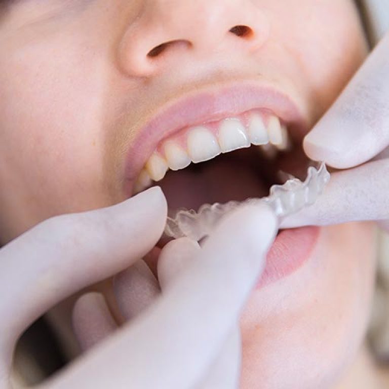 uniq-dent-ortodonti-kutu-gorsel-001